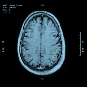 Brain scan technology could be used as a lie detector in the future, but it needs some improving.
