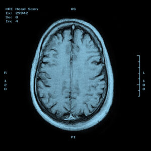 Escaneo de cerebros se puede utilizar como detector de mentiras, pero se necesitaría mejorarlo.